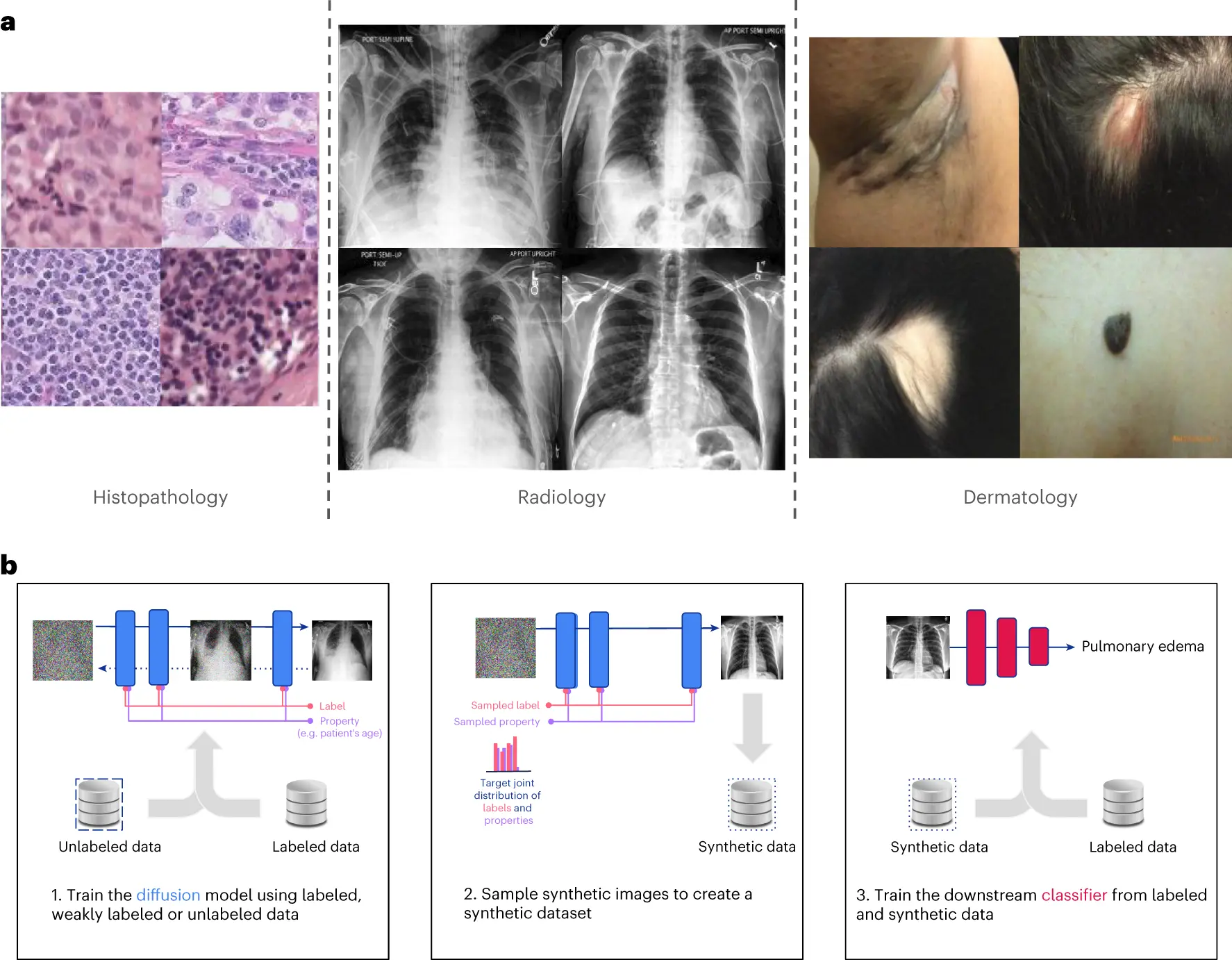 Overview of generative models improving fairness in medical imaging